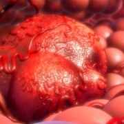ESMO-releases-the-first-guideline-on-NGS-testing-in-cancers