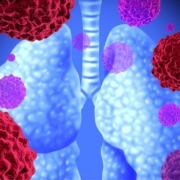 Selpercatinib-displays-efficacy-in-RET-fusion-positive-non-small-cell-lung-cancer