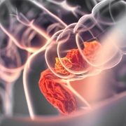 Effect-of-prior-therapy-on-BRAF-V600E-mutant-metastatic-colorectal-cancer