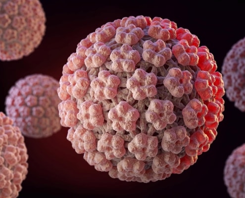 HPV-immunisation-in-UK-lowers-the-incidence-of-cervical-cancer-and-CIN3