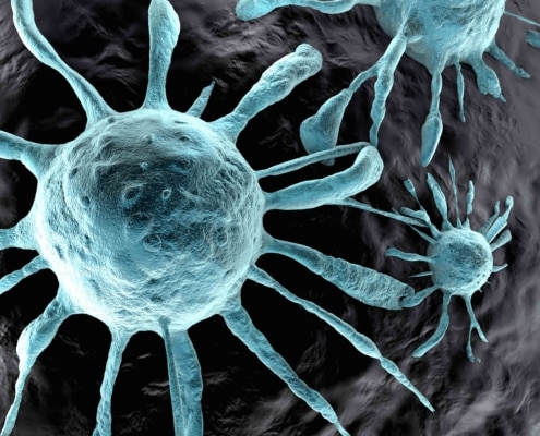 US and Chinese Studies Suggest More Severe Outcomes in COVID-19 Patients with Cancer